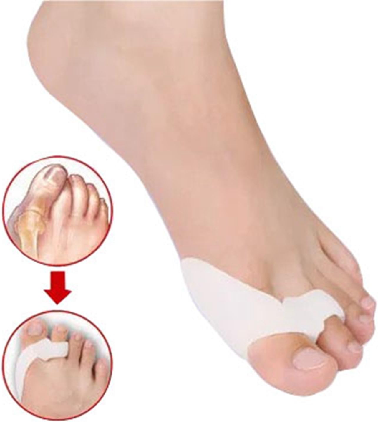 MOMEPE 2 Pairs Relief Hallux Rigidus Bunion Correctors 2 Holes Toe Separators White