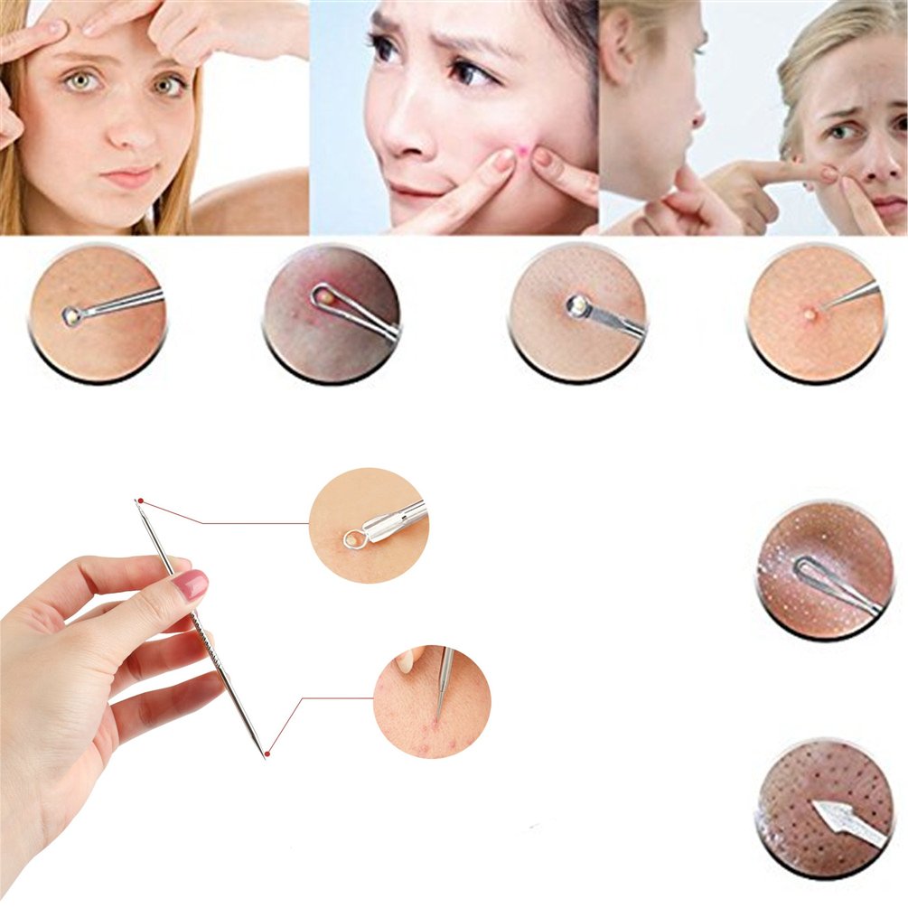 Blackhead Remover Tools, Excellent for Acne Treatment, Pimple Popping, Blackhead Extraction, Zit Removing, Blemish Removal, IOQSOF Blemish Pimple Whitehead Blackhead Acne