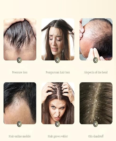 GINGER ANTI HAIR LOSS SHAMPOO, PLANT SHAMPOO FOR HAIR GROWTH OIL CONTROL HAIR CARE FOR WOMEN MEN.(1 BOX)