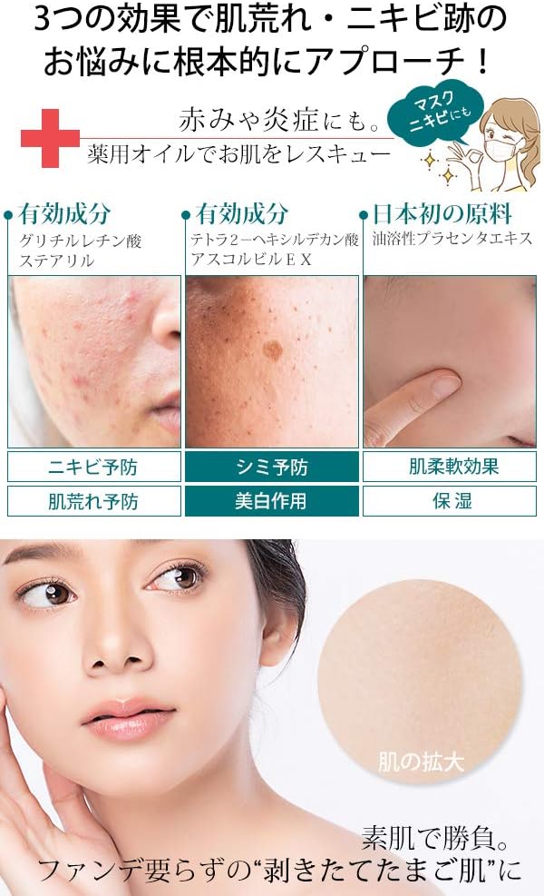 Amazon 医薬部外品 薬用 ニキビ 跡 対策 美容 オイル 50ｍl Medisthe ニキビケア ブースターオイル 保湿 美容液 エッセンス 大人 にきび 毛穴 アクネ ケア 吹き出物 肌荒れ スキンケア モイスチャー フェイス セラム さっぱり 敏感肌 乾燥肌 顔