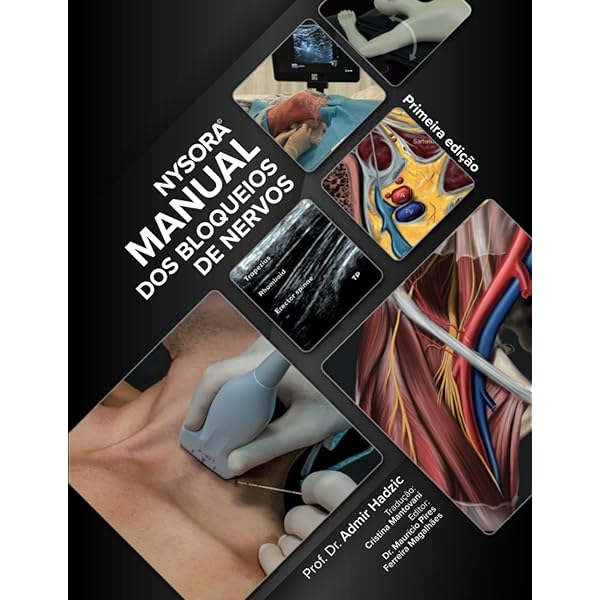 NYSORA Nerve Block Manual: First Edition: 9798987050507: Medicine