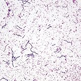 Mixed Gram-Positive and Gram-Negative Bacillus, w.m. Gram Stain Microscope Slide