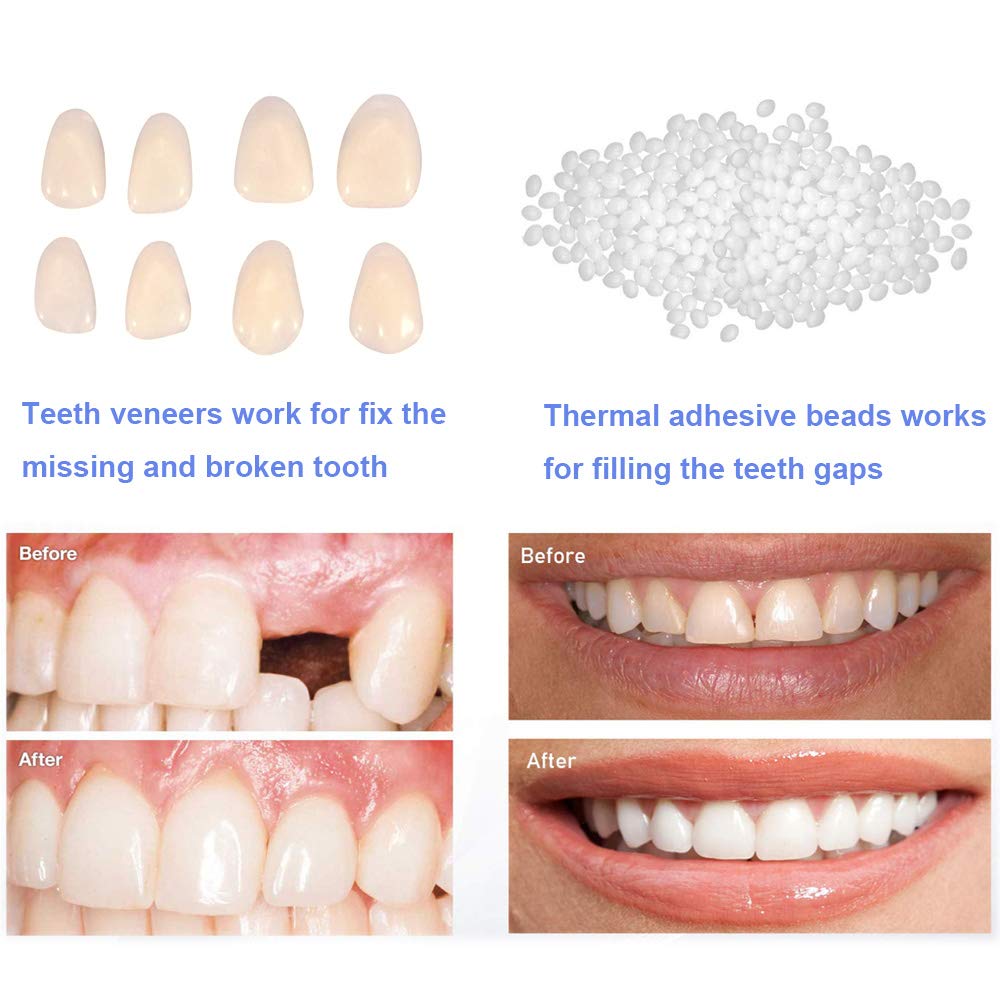 Temporary Tooth Repair Kit-Teeth Veneers for Fix the Missing Tooth Teaching，Thermal Fitting Beads for Filling the Broken Tooth and Teeth Gap, Resin Fake Teeth Crown : Beauty