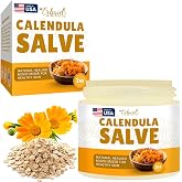 Calendula Ointment &ndash; Calendula Cream &amp; Natural Calendula Salve &ndash; Repair Ointment for Itch Relief &amp; Dry Skin &ndash; Herbal Care for Cuts, Burns, Bug Bites, Diaper Rash &amp; Tattoo Care &ndash; Gentle for Babies
