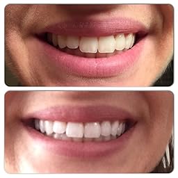  System for a Healthier Mouth and Whiter Teeth - 4.0 Oz and 2.3 Oz