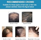 Lophe Professional Hair Building Fibers Brown for Thinning Hair Hair Thickening view 4