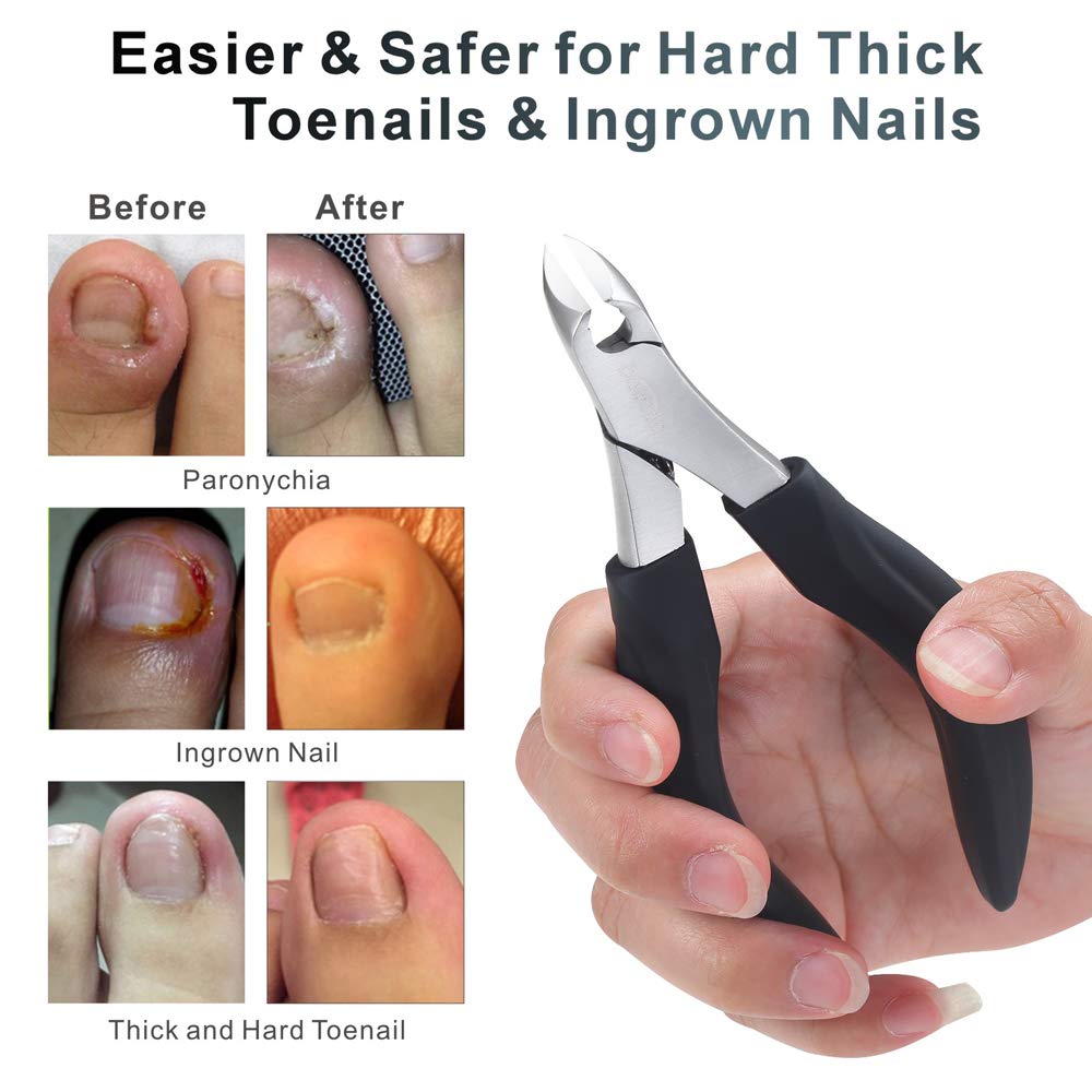 Bacada Upgraded Toenail Clipper for Thick or Ingrown Nails