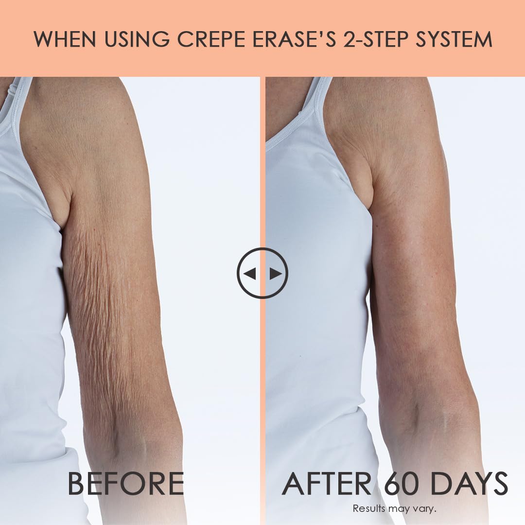 BODY FIRM Crepe Erase 2-Step Advanced Treatment, Anti-Aging Skin Care, Firming Moisturizer Cream + Body Exfoliating Pre-Treatment, Supports Wrinkle, Crepe Skin, Collagen