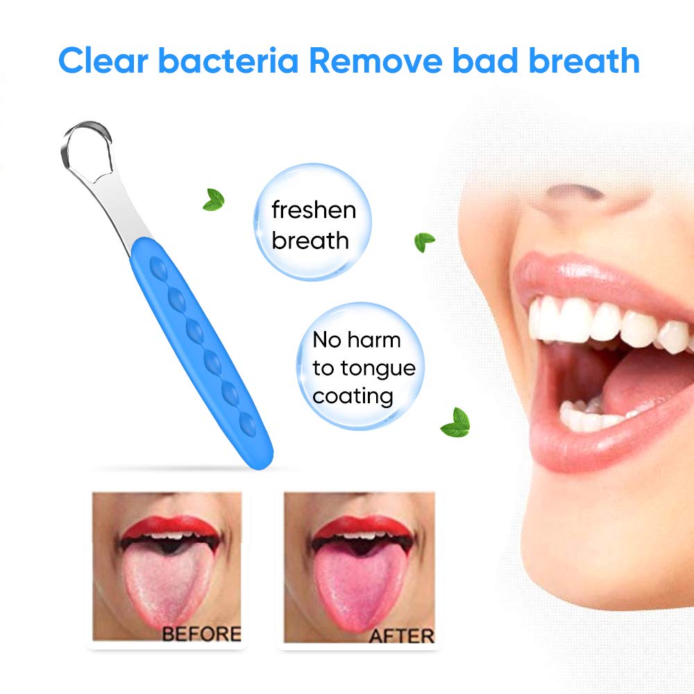 2020 New Version Tongue Scraper Cleaner for Adults & Kids, Medical Grade Metal Tongue Brushes Set for Fresh Breath Dental Eliminate Bad Breath in Seconds (2 pcs) : Beauty