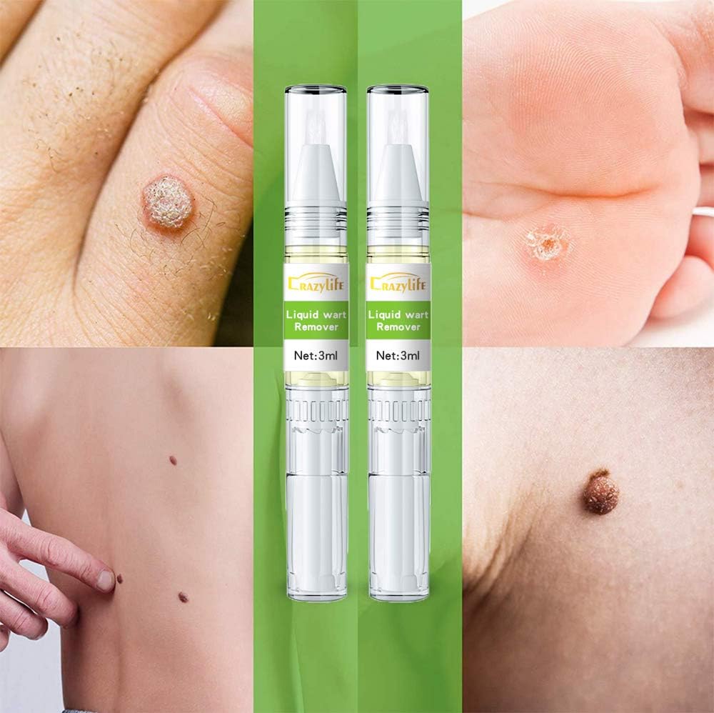 Skin Tag Remover Wart Remover for Neck Quickly Tag Mole Remover for Common and Plantar Warts,2pcs: Health & Personal Care