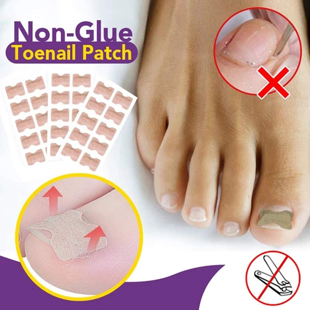 3 Set Glue Free Toenail Patch - Ingrown Toenail Correction Sticker Professional Pedicure for Men Women Toenail Care Tool: Beauty