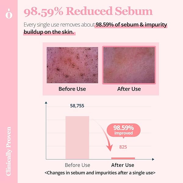 ONGREDIENTS PORE CLEANSING PADS, EXFOLIATING FACE WIPES, MAKEUP REMOVER WIPES FOR FACE, PORE REDUCING, EXFOLIATING, KOREAN CLEANSING PAD SHEETS, KOREAN SKIN CARE (60 PADS)