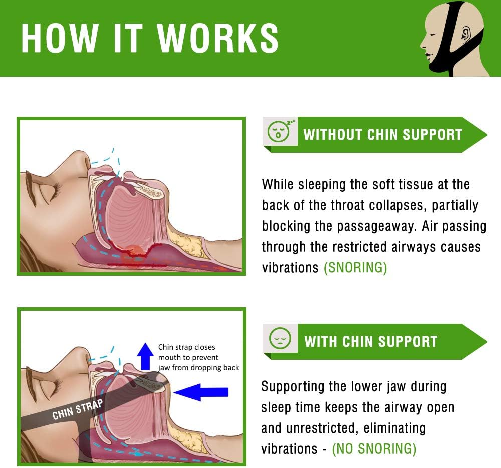 CPAP Bi-Pap VPAP BPAP TMJ Chin Strap Anti Snoring Chin Strap for Men and for Women - Snore No More by Vivélle, Slim-Non-Slip, Adjustable, Premium Snore Stopper Device That Helps You Day and Night: Health & Personal Care