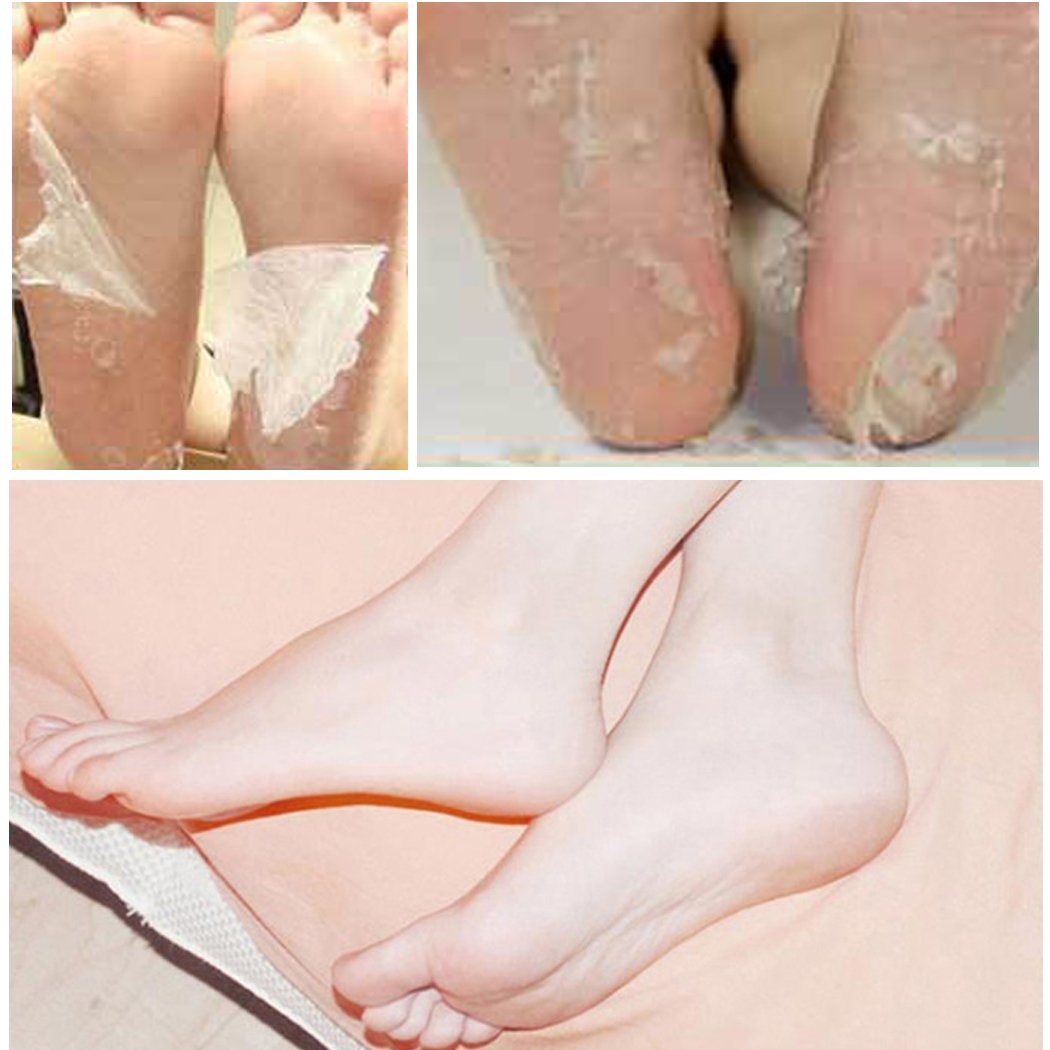 Lantusi Exfoliating Foot Peeling Mask Renewal Mask Peels Away Calluses and Dead Skin
