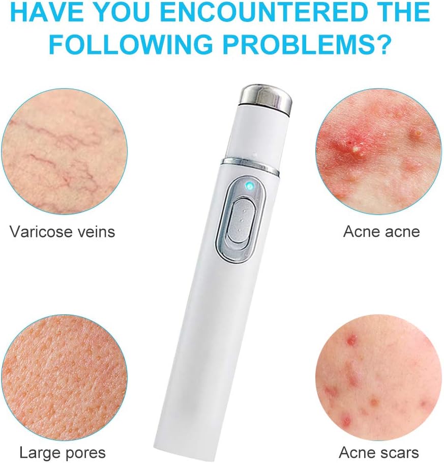 Blue Light Therapy Pen For Varicose Veins,Acne Removal Pen,Acne Scar