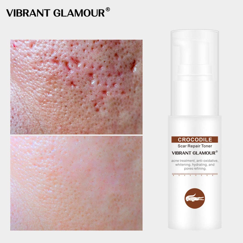 crocodile cream for stretch marks
