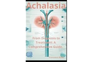 Achalasia: From Diagnosis to Treatment: A Comprehensive Guide.
