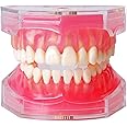 Standard Study Teaching Dental Model with All Removable Teeth - Soft Silicone Gel Gum and Bendable Teeth Typodonts for Students and Professionals - Ideal for Dental Education and Demonstrations