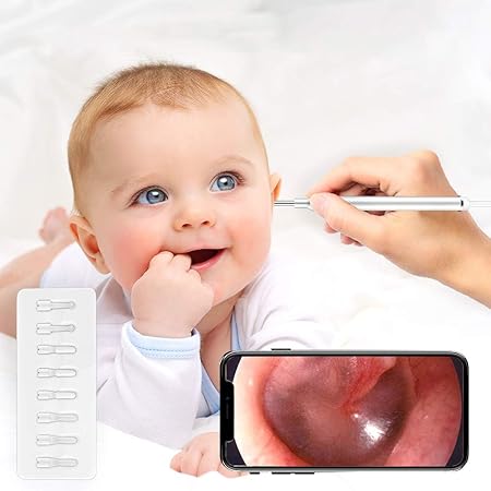 Amazon 耳かき カメラ スコープ 耳鏡 Hd超高清 耳のケア 内視鏡 電子耳鏡 鼻カメラ 耳 スコープ 耳かきに協力 耳垢クリーナー Ledライト付き Androidスマホ Windows Pc対応ip67防水性能 130万画像 3 9mmレンズ 子供 大人用 Wifi発信機なし Vialove ドラッグストア