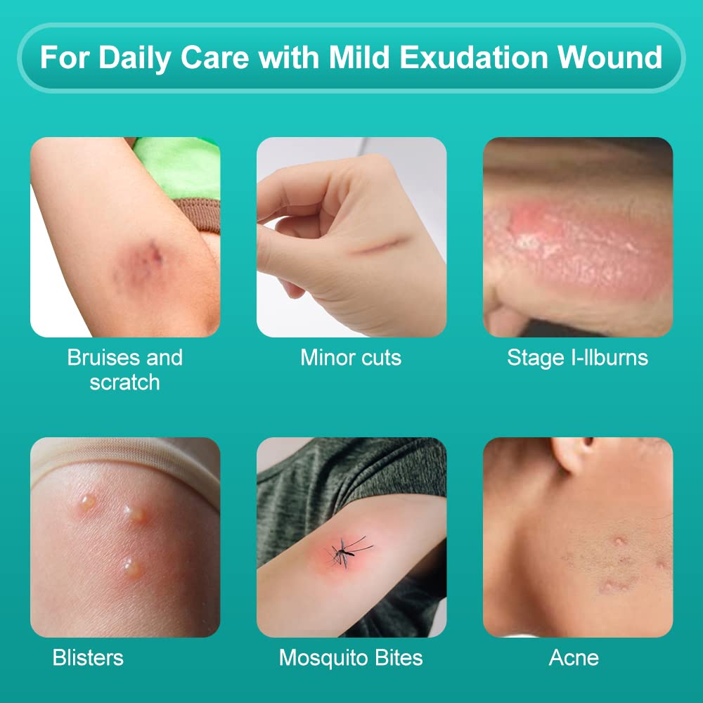 Dimora Hydrocolloid Wound Dressing, 10 Pcs Ultra Thin 4