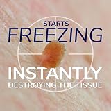 Dr. Scholl's Scholl Freeze Away Skin Tag Removal Kit 12 Treatments view 4