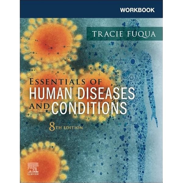 健康・医学 Common Diseases Up to date 817nZg1n4SL._UF350,350_QL50_.jpg