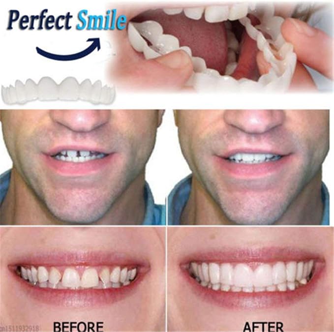 Design Pratico Uomo Donna Denti Istantaneo Sorriso Perfetto Comfort Fit Denti Flettenti Adatto Per Un Sorriso Sbiancante Copertura Per Denti Finti Amazon It Salute E Cura Della Persona
