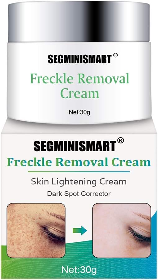 segminismart freckle cream