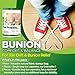 Bunion Corrector - Orthopedic Bunion Corrector for Big Toe - Toe Separators Help Provide Bunion Relief - Straightens Toes - Soft Medical Grade Gel - Comfortably Worn with Or Without Shoes
