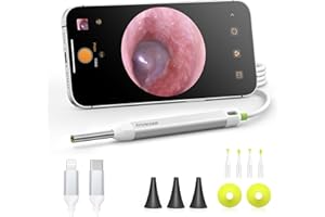 AnyScope Digital Otoscope with Gyroscope, HD Ear Camera with Ear Wax Removal Tools, Video Ear Scope Otoscope with Light, Compatible with iPhone and Android (Silver)