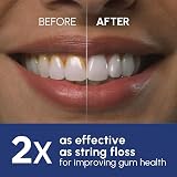 Waterpik Ultra Professional WP-662UK Black Water Flosser 5 Tips 10 Settings view 3