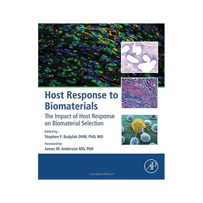 Host Response to Biomaterials: The Impact of Host Response on ...