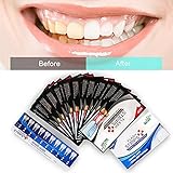 Activated Charcoal Teeth Whitening Strips,Teeth Whitening Kit,Black Teeth Strips,Teeth Bleaching, Advanced Formula with Natural Activated Charcoal 20 Strips with a Fresh Mint Flavor …