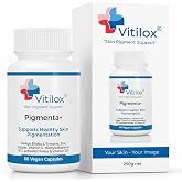 Vitilox Pigmenta+ Advanced, Skin Tone Support Supplement &ndash; 60 Tablets | 2 Months | Natural Vitiligo Skin Pigmentation Support | Reduce White Body Spots