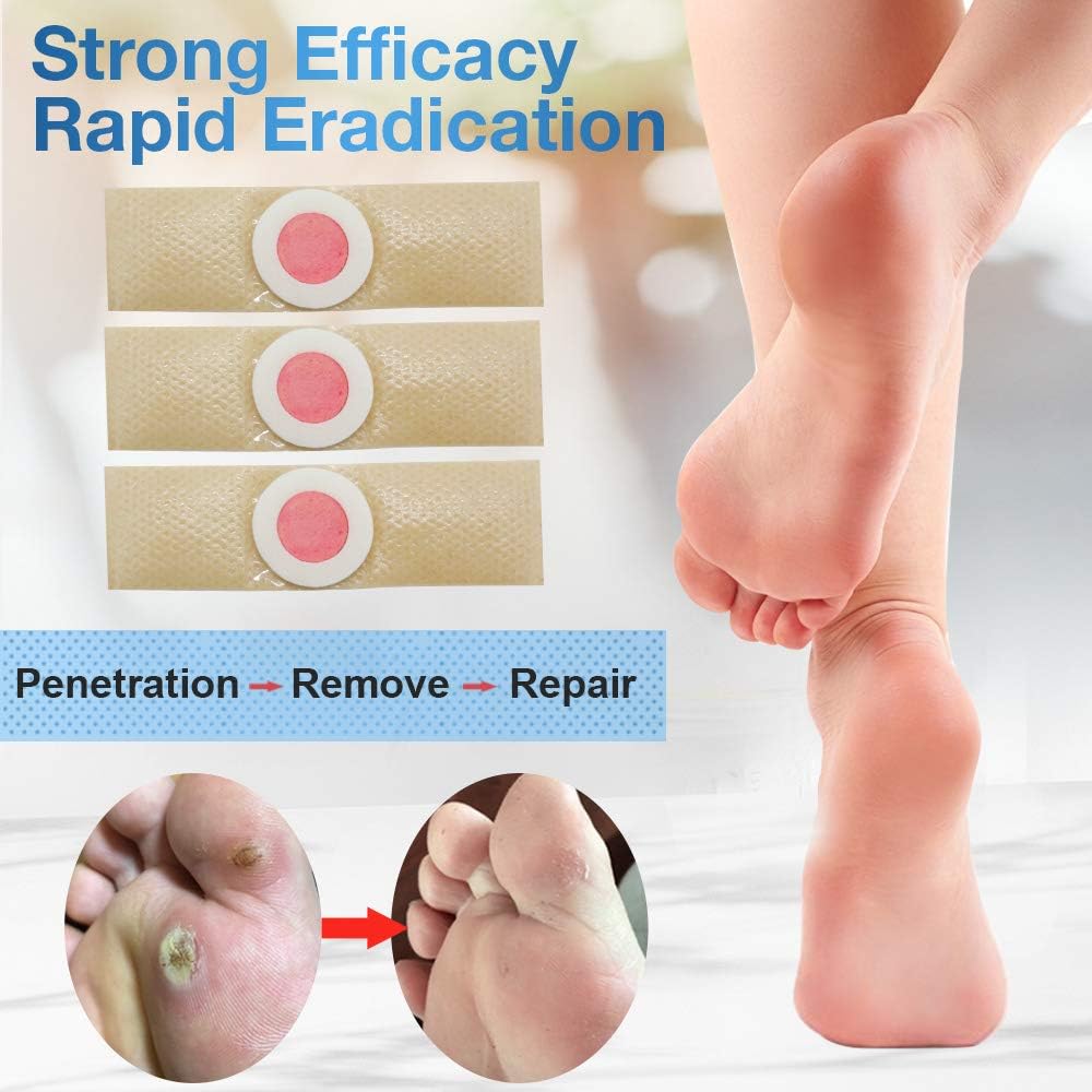 Wart Remover, Wart Removal Plasters Pad, Foot Corn Removal Plaster with Hole, Penetrates and Removes Common and Plantar Warts, Callus,Stops Wart Regrowth 24 Pcs/Box: Health & Personal Care