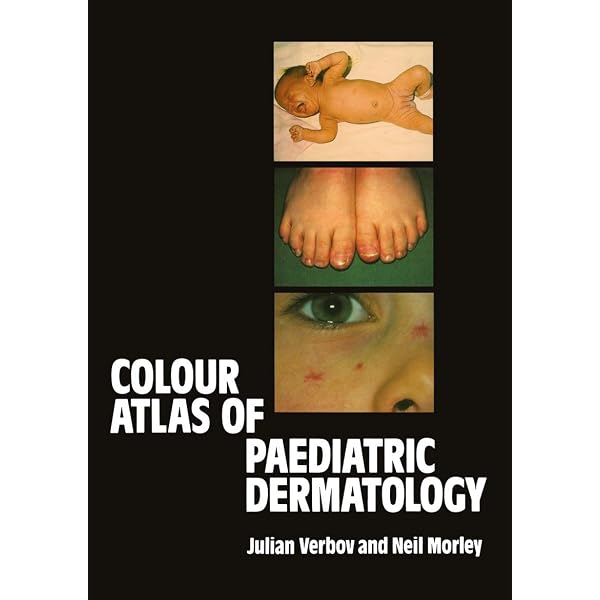 Color Atlas of Pediatric Surgery: Liebert, Peter S.: 9780444013286