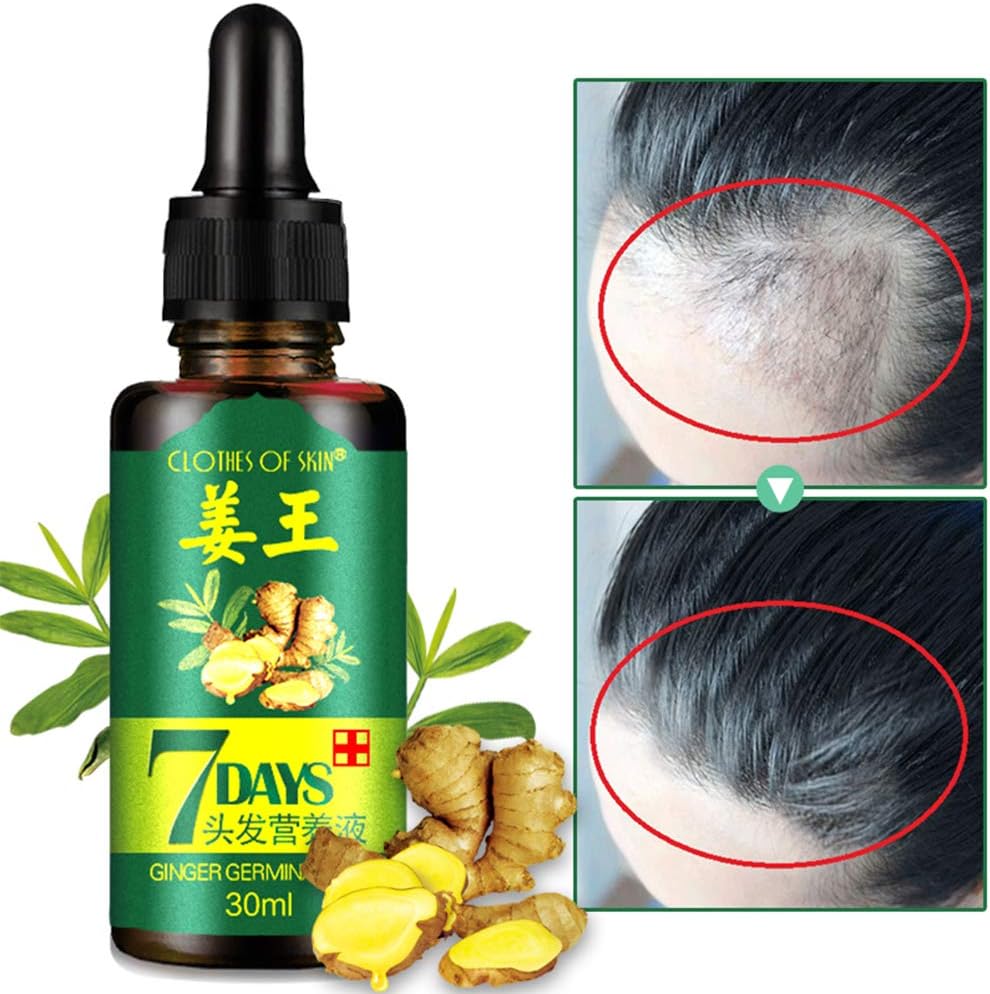 Prettyui Ginger Germinal Oil Ginger Essential Oil Hair Growth Hair Loss Treatment Hair Growth Serum 30ml (Ginger Germinal Oil)