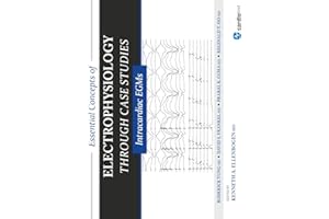 Essential Concepts of Electrophysiology Through Case Studies: Intracardiac EGMs