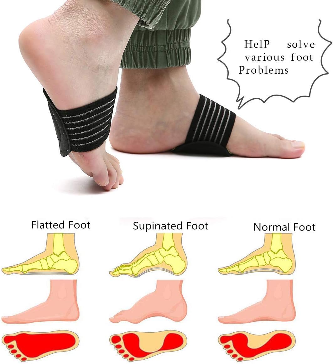 CHARMINER 2 Pairs Compression Fasciitis Cushioned Support Sleeves, Plantar Fasciitis Foot Relief Cushions for Plantar Fasciitis, Fallen Arches, Achy Feet Problems for Men and Women: Health & Personal Care