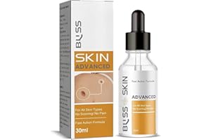 QKDBLWX Fast Acting Gel Wart Remover Freeze Off - Fast-Acting Wart Freeze Off - Wart Removal for Plantar Wart, Genital Wart, H Warts, Common Wart, Flat Wart, Warts, Plantar Wart Remover for Feet 1