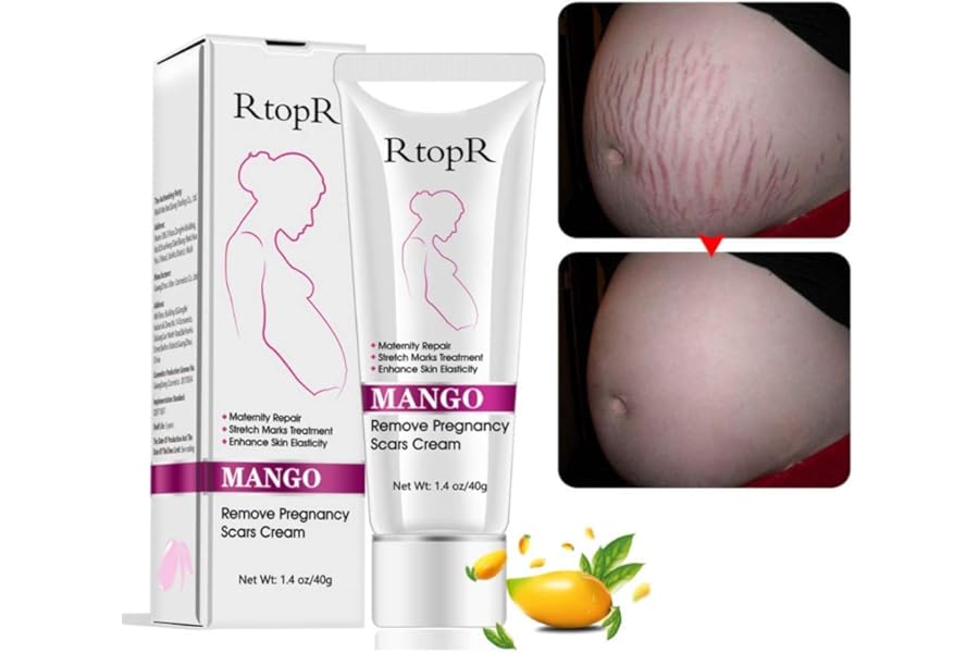 Mango Stretch Marks and Scar Cream, Stretch Mark and Scar Removal Cream for Pregnancy, Belly Creams for Wrinkles, Obesity Fat Marks Scars Moisturizing, Remove Marks (40g)