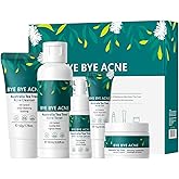 Skin Care Set,Acne Treatment for Face Skin Care Sets & Kits,Tea Tree Essential Oil Facial Skincare Gift Set with Cleanser,Toner,Serum,Gel, Acne Treatment Kit Cream Skin Care for Teens 10-12 Girls Boys
