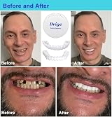 JUXINE 4 Pairs False Teeth Instant Veneers Temporary Dentures Snap on Smile view 7
