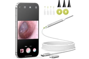 Anykit USB Otoscope for iPhone, iPad & Android Device, Clear View Ear Camera with Ear Wax Removal Tools, Ear Scope Endoscope with LED Lights, Support Capture Photo & Record Videos