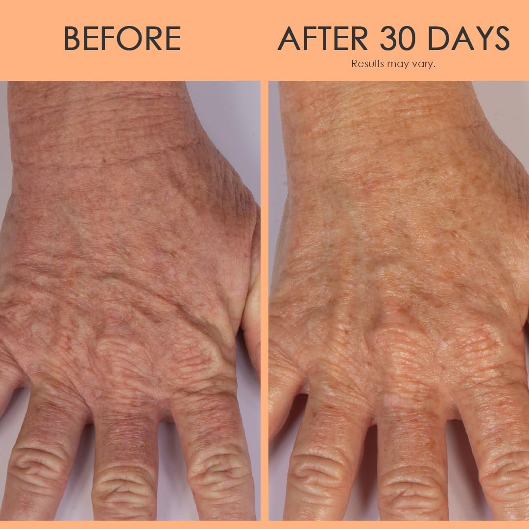 Crepe Erase Ultra-Reparative Hand Cream, Anti-Aging Hand Treatment, Lotion with Moisturizing Shea Butter, Vitamin E and Squalane for Cracked, Dry Hands, Supports Wrinkle on Hands, 3 fl oz