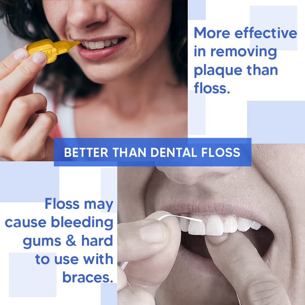View 4