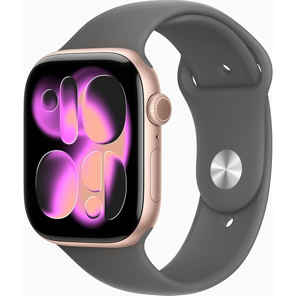 Amazon.com: Apple Watch Series 4 (GPS, 40mm) - Gold Aluminum Case