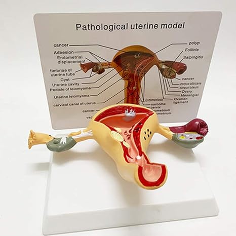 Amazon Co Jp 子宮病理モデル 子宮および卵巣モデル 教育用の医学的解剖学的ヒ ト卵巣膣疾患 断面研究ツール ホーム キッチン
