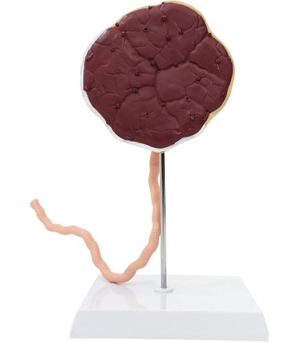 Wellden Medical Anatomical Placenta Model with Removable Umbilical