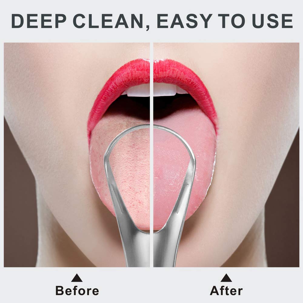 Tongue Cleaner Scraper, Surgical Stainless Steel Tongue Brush Professional Eliminate Bad Breath, Rustproof Tongue Scrapers Reusable Lifetime Dental Scraper